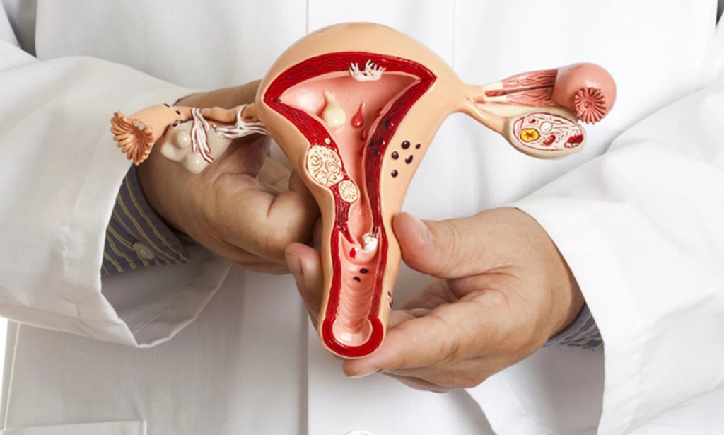 Міома матки: чим вона небезпечна і як її лікують сьогодні?